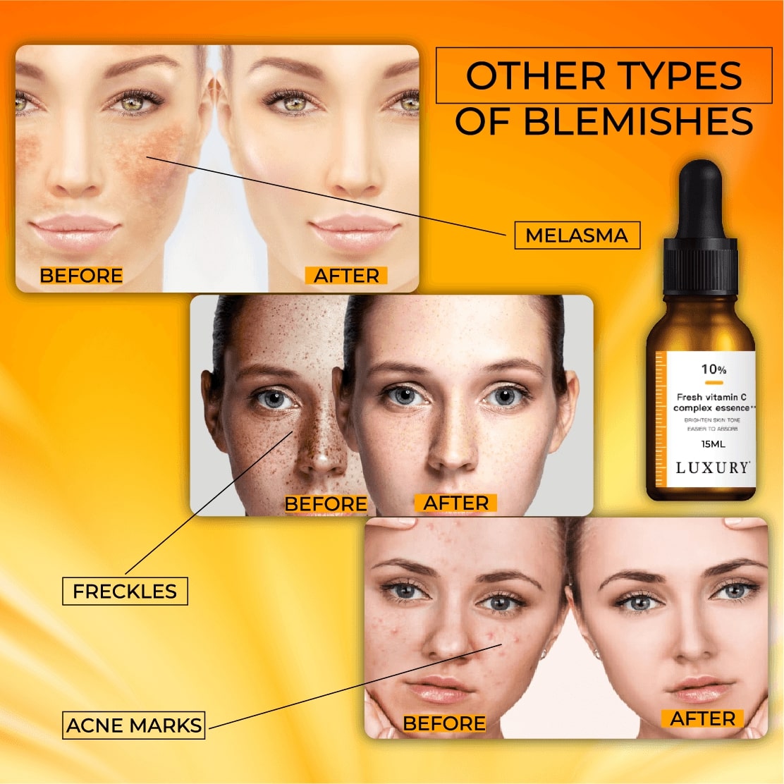 BlemishSkin Corrector Serum