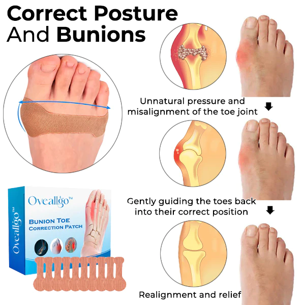 Oveallgo Bunion Toe Correction Patch