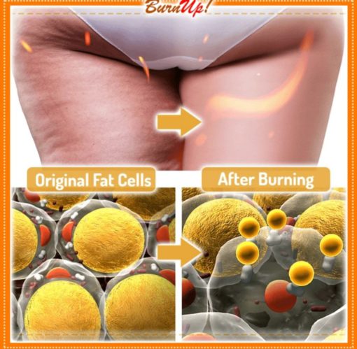 BurnUp! Ultimate Cellulite Heating Spray (10ml)