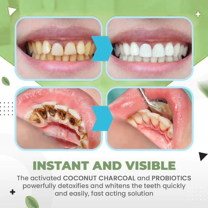 SmileMate Removal of Tartar and Plaque Bacteria and Various Oral Problems