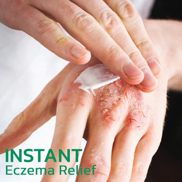 EczmoTherapy Herbal Healing Cream