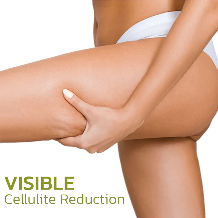 GFOUK HerbalLegs Cellulite Reduction Patches