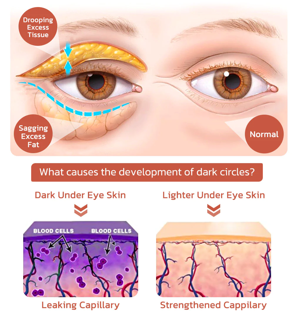 flysmus CaffeineEYES Repair and Lifting Eye Cream