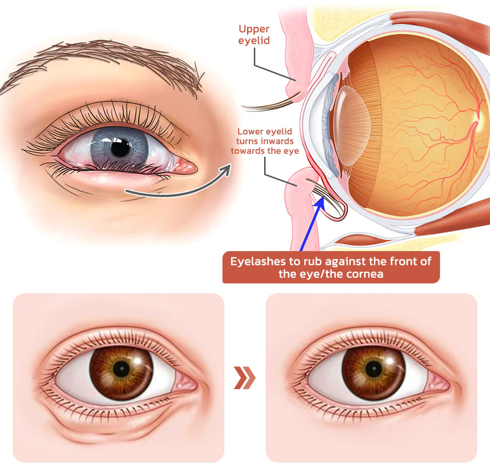 flysmus CaffeineEYES Repair and Lifting Eye Cream