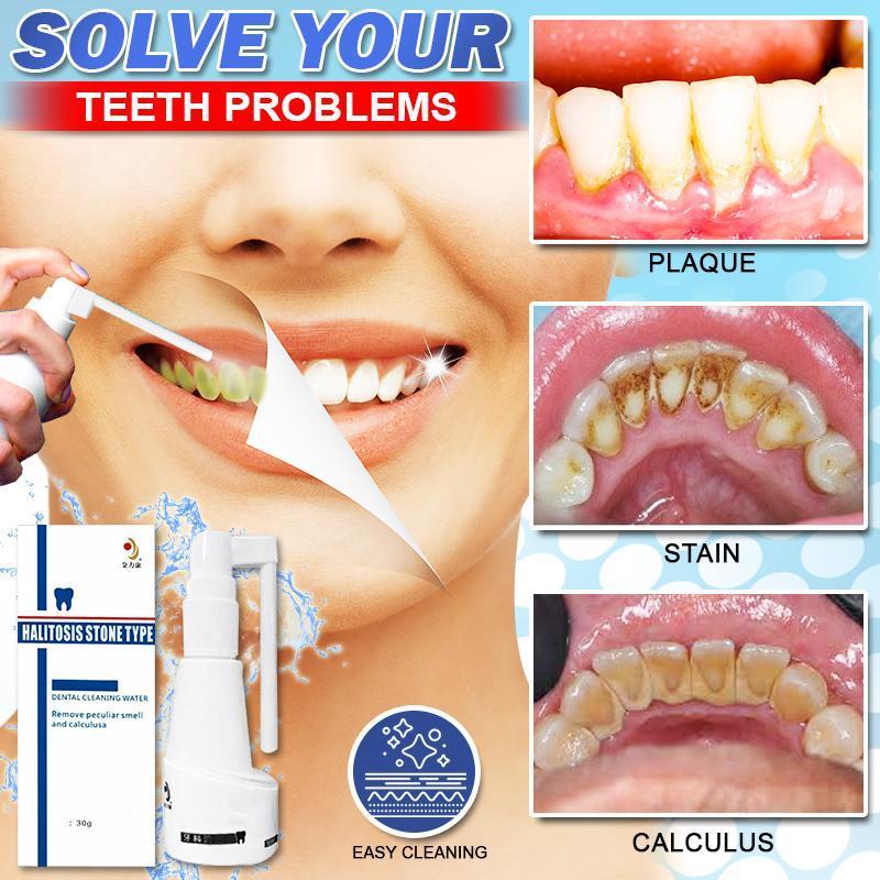 Calculus Free Dissolving Dental Spray