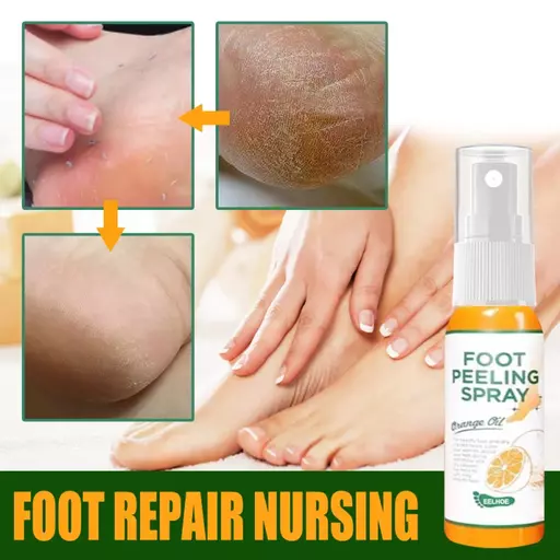 Callus Off Foot Reglow Spray