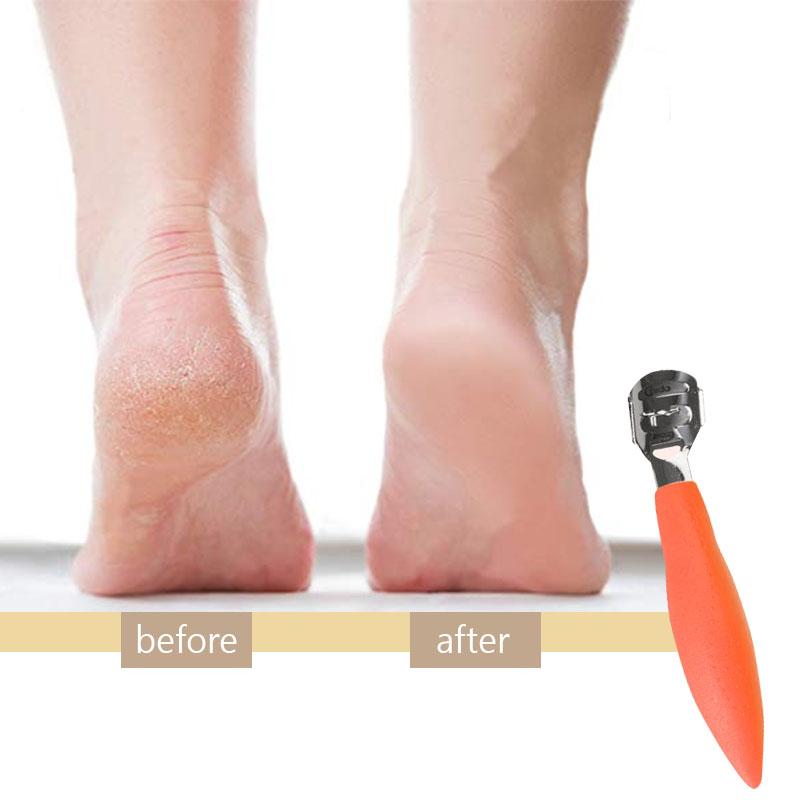 CallusRemedy Foot Tool