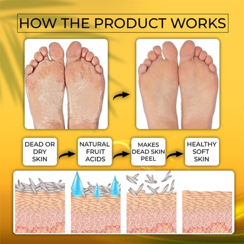 CallusRemover Relaxing FootMask