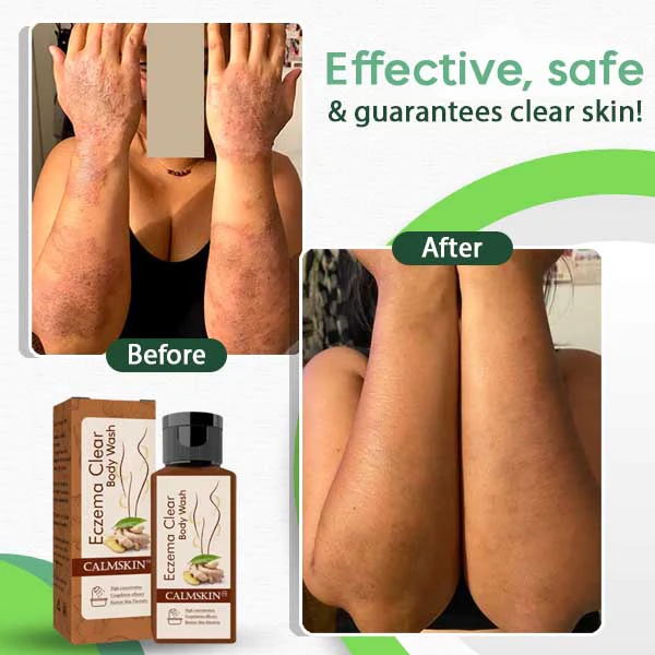 CalmSkin Eczema Clear Body Wash