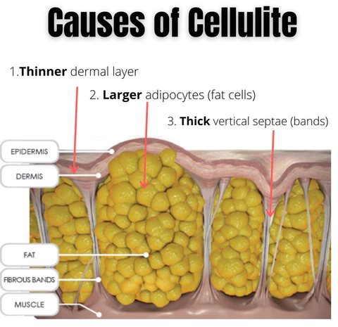 CelluLoss Herbal Tightening Body-Balm