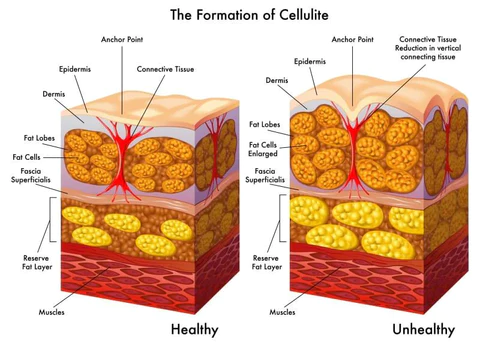 CelluLoss Herbal Tightening Body-Balm