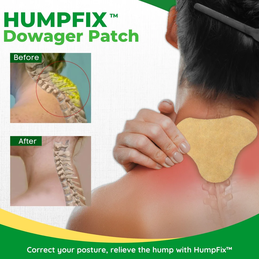 HumpFix Dowager Patch