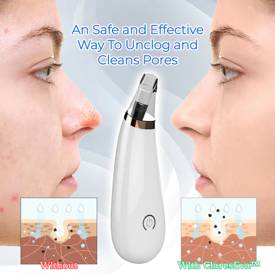 Pore Vacuum Cleaner For Blackheads