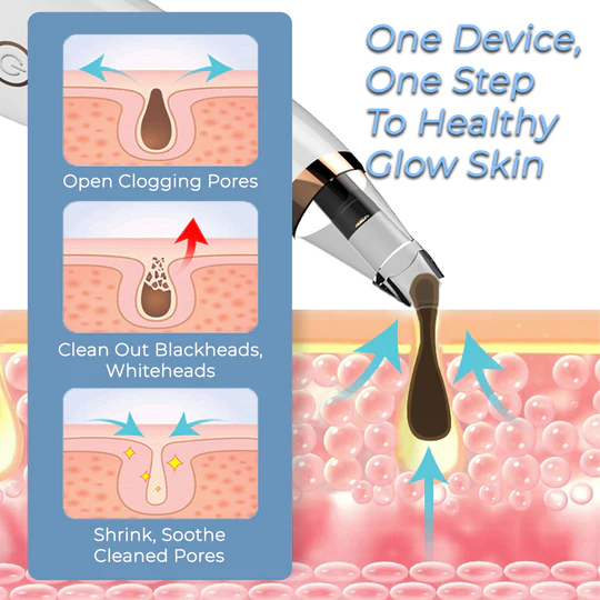 Pore Vacuum Cleaner For Blackheads