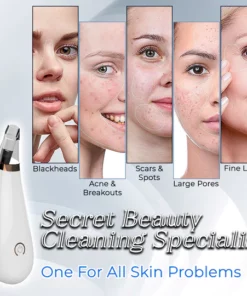 Pore Vacuum Cleaner For Blackheads