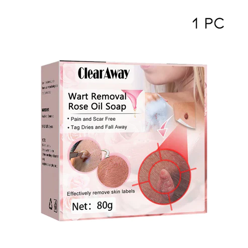 Oveallgo Wart NanoPURI Removal Rose Oil Soap