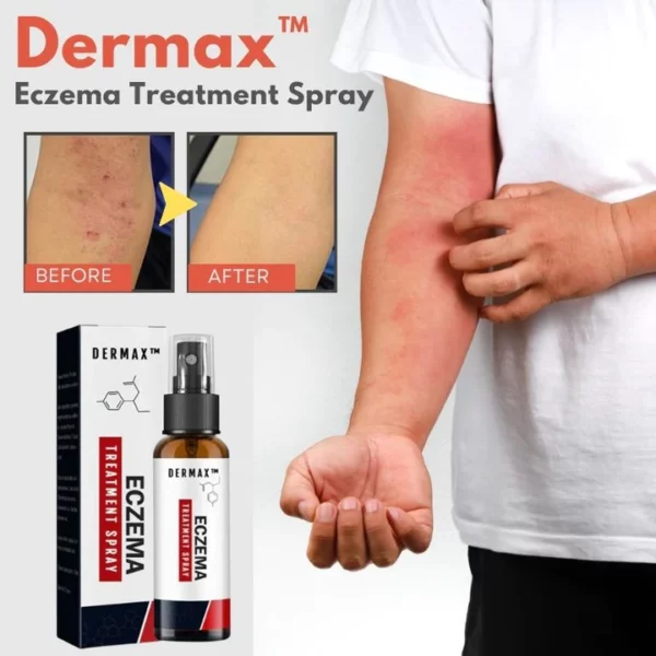 Dermax Eczema Treatment Spray