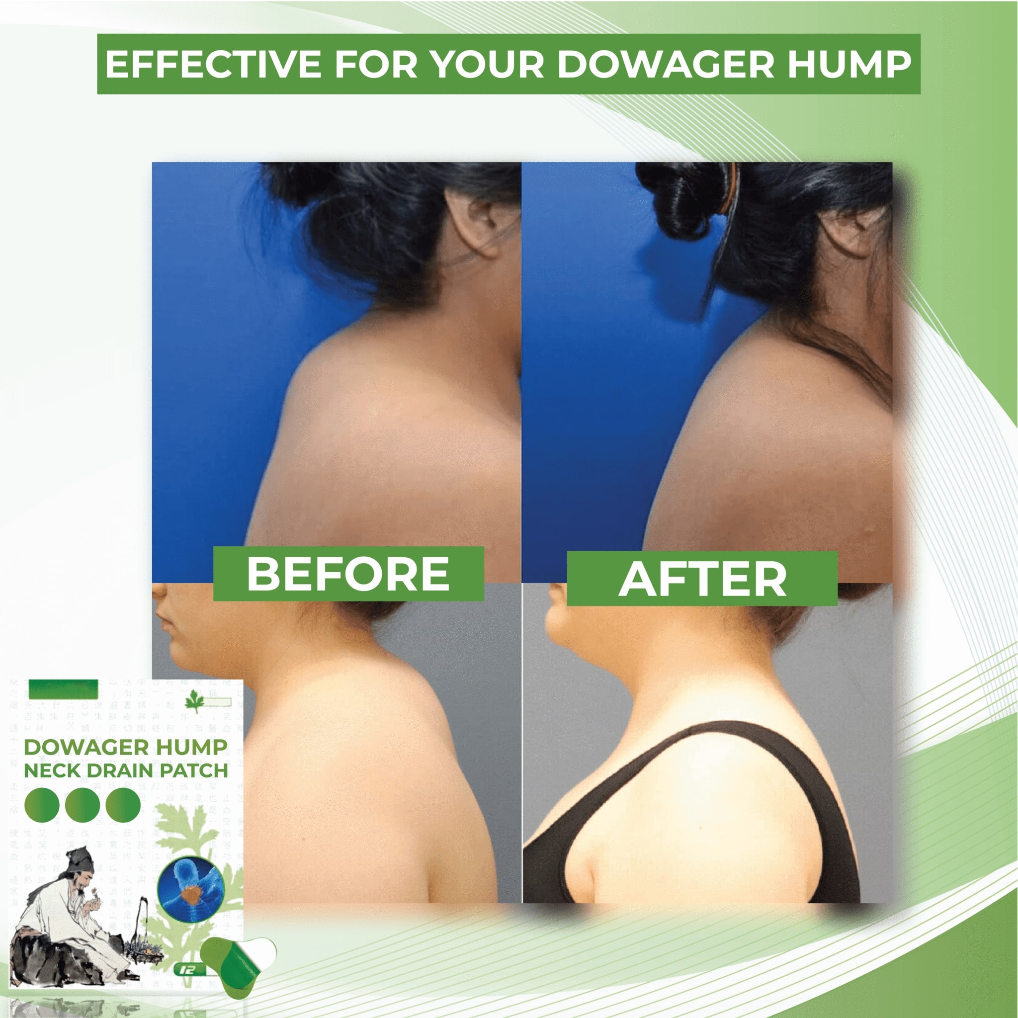 Dowager Hump Neck Drain Patch