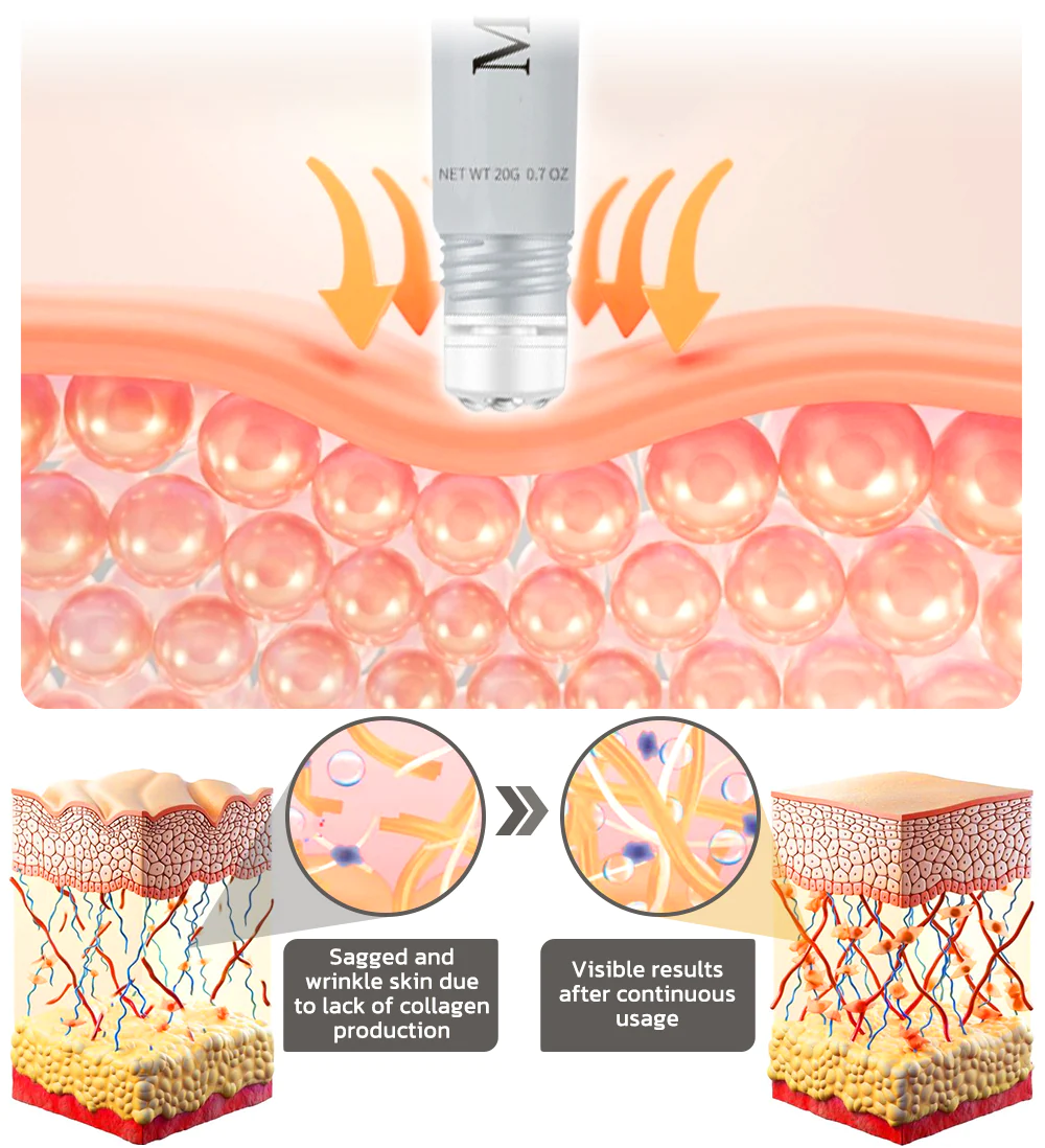 flysmus Milkia Spot Removal Lifting Eye Gel