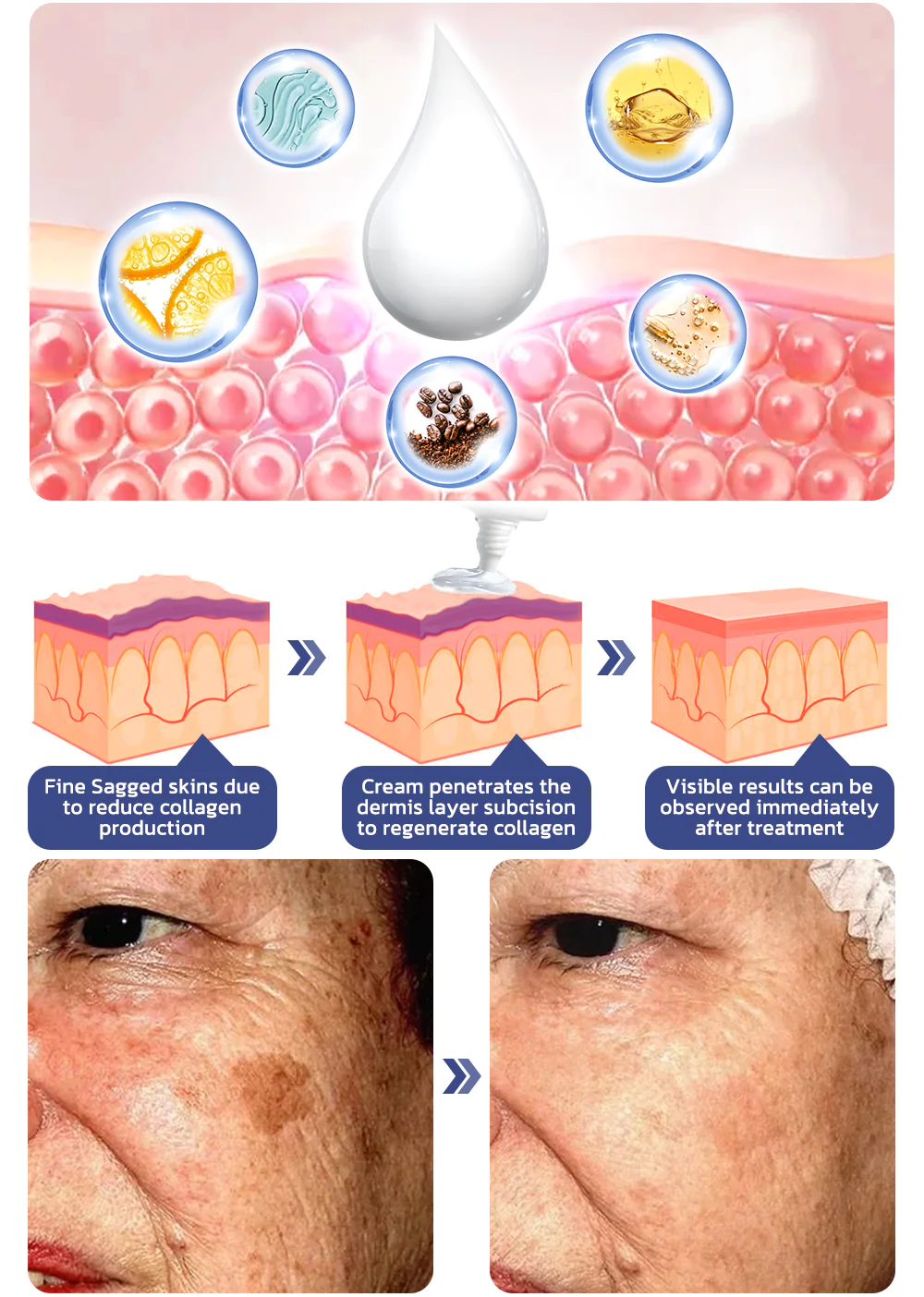 flysmus RENEWEYES Pigmented Correcting Firming Eye Cream