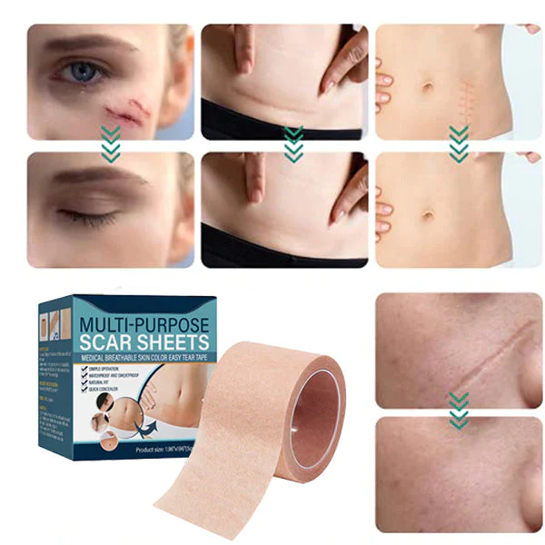 ELAIMEI Medical Soft Silicone Gel Tape