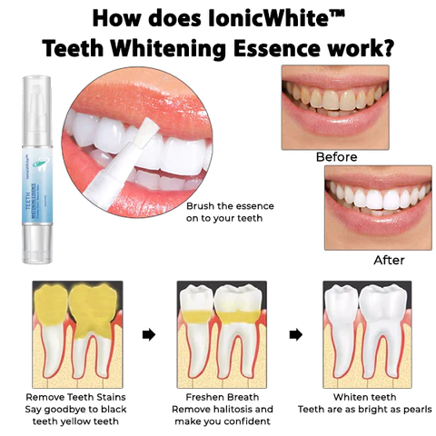 IonicWhite Teeth Whitening Essence