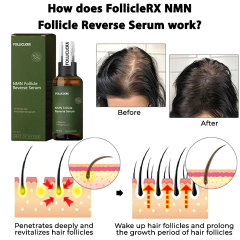 FollicleRX NMN Follicle Reverse Serum