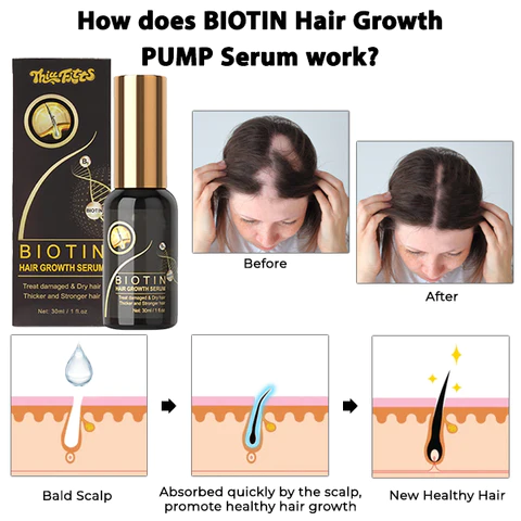 Thiccfitts BIOTIN Hair Growth PUMP Serum