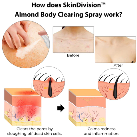 SkinDivision Almond Body Clearing Spray