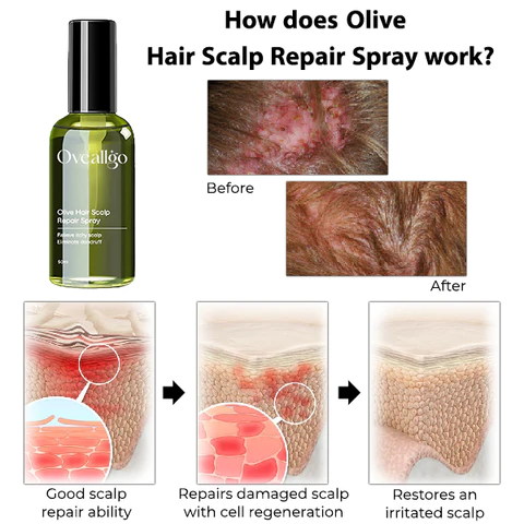 Oveallgo Olive Hair Scalp Repair Spray