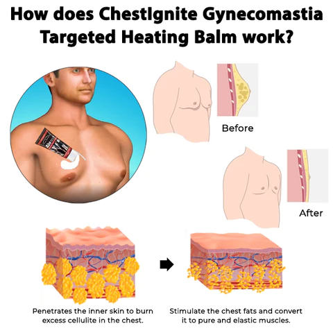 ChestIgnitePLUS Gynecomastia Targeted Heating Balm