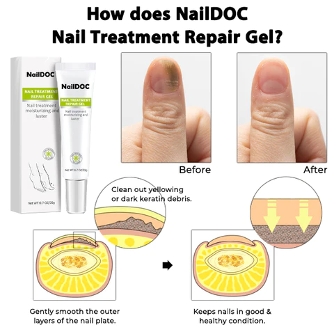 NailDOC Nail Treatment Repair Gel