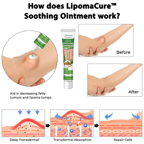 LipomaCure SCI Soothing Ointment