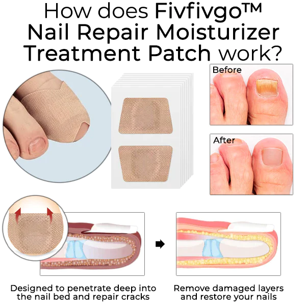 Oveallgo Nail Repair Moisturizer Treatment Patch