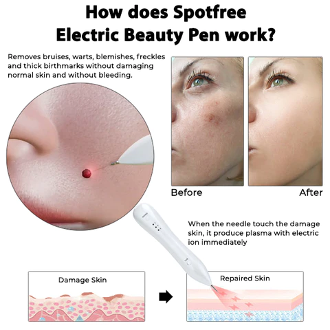 SpotfreePRO Electric Beauty Pen