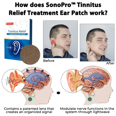 GERMAN SonoPro Tinnitus Relief Treatment Ear Patch