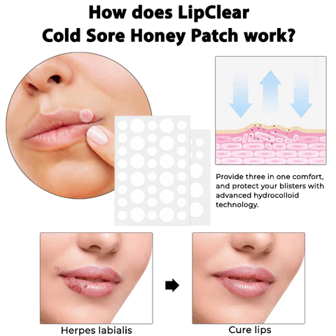 LipClear Cold Sore Honey Patch