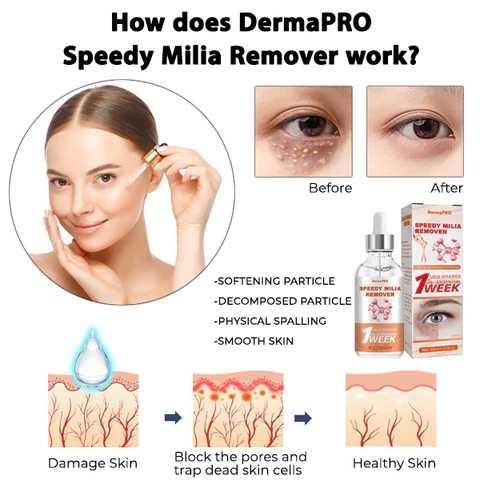 DermaPRO Speedy Milia Remover