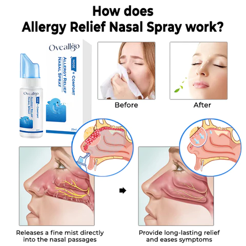 Oveallgo Allergy Relief Nasal Spray