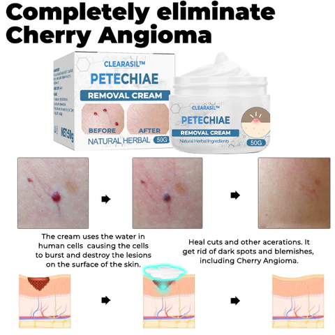 Clearasil Petechiae Removal Cream