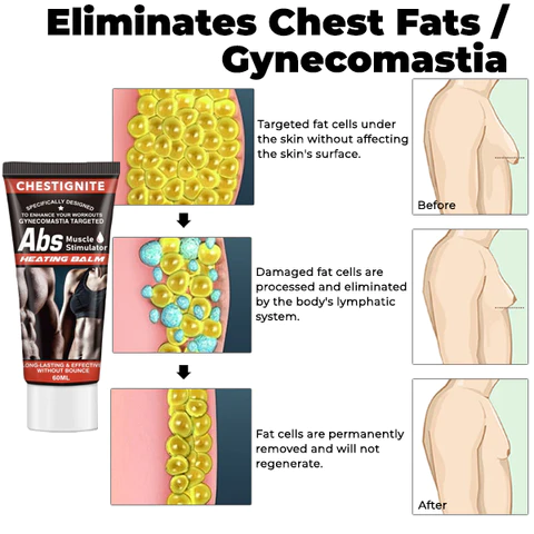 ChestIgnitePLUS Gynecomastia Targeted Heating Balm