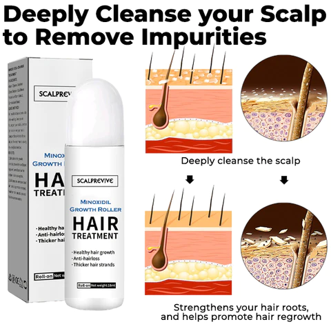 Oveallgo ScalpRevive PRO Minoxidil Growth Roller