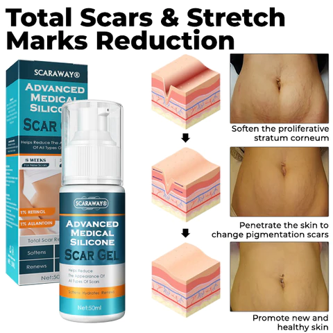 ScarAwayŽ Advanced Medical Silicone Scar Gel