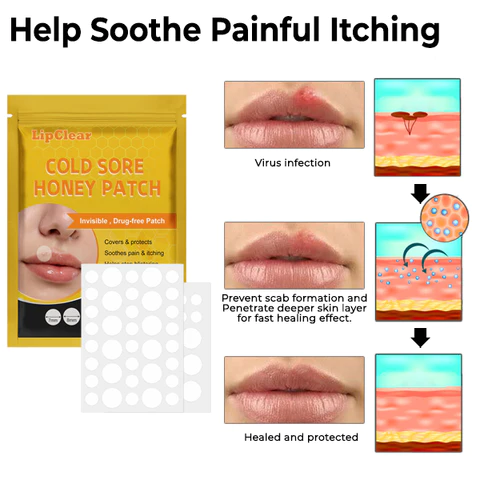 LipClear Cold Sore Honey Patch