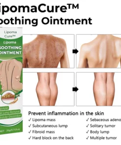 LipomaCure SCI Soothing Ointment