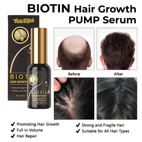 Thiccfitts BIOTIN Hair Growth PUMP Serum