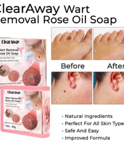 ClearAway PRO Wart Removal Rose Oil Soap