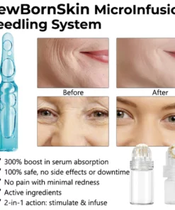 Oveallgo NewBornSkin MicroInfusion Needling System