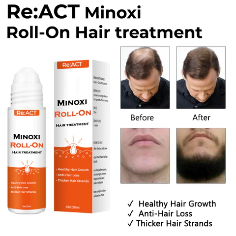 Ceoerty Roll-On Hair Regrow Treatment