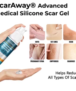 ScarAwayŽ Advanced Medical Silicone Scar Gel